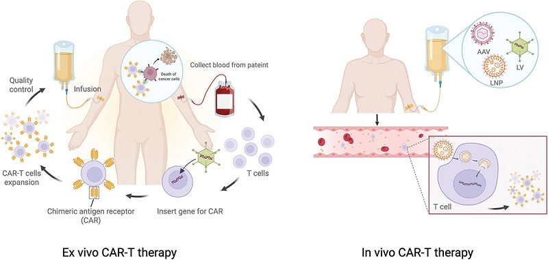 Ex vivo CAR-T and in Vivo CAR-T